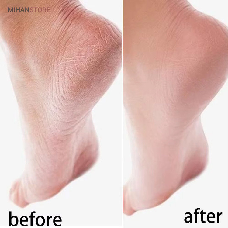 جوراب سیلیکونی ترک پا Spa Gel Socks